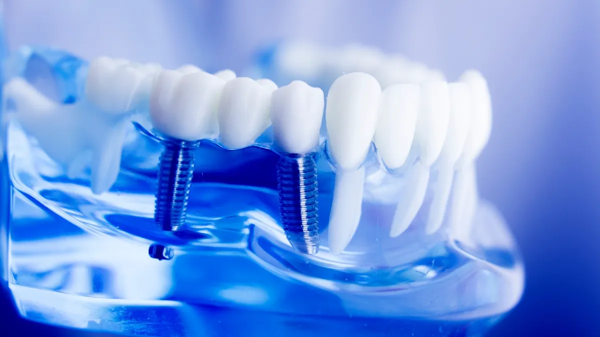 A model jaw showing a bridge carried by two dental implants