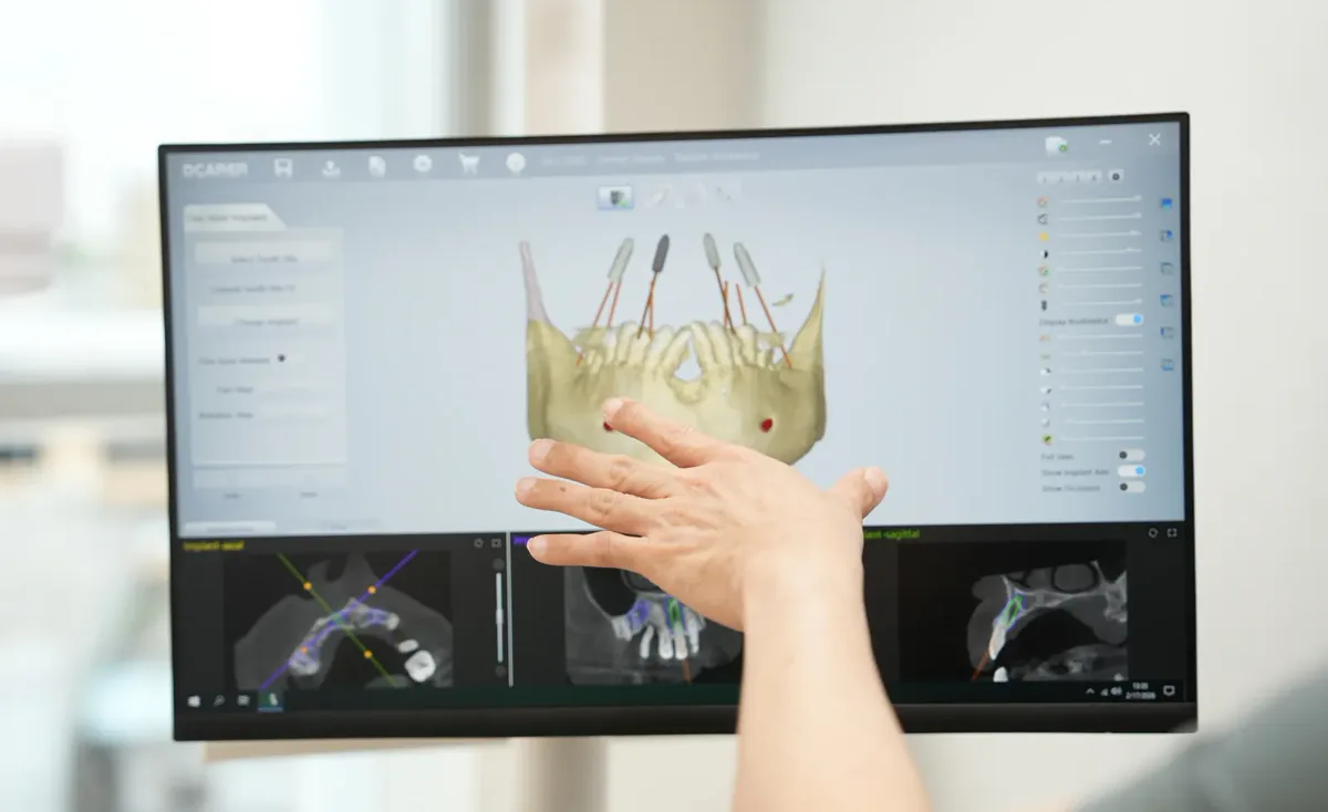 A dentist pointing to an implant position on the planning screen