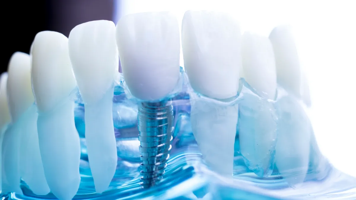 A model jaw showing a single dental implant in place of one tooth