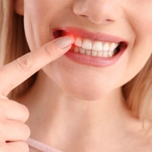 Periodontal Treatment