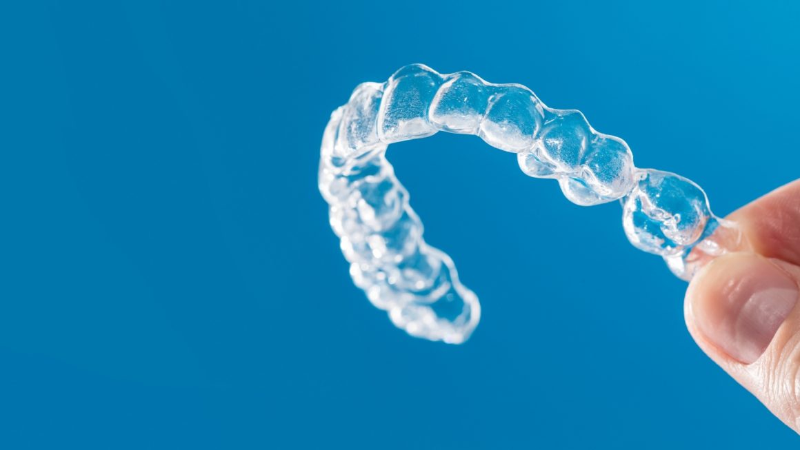 Clear braces/wires (Orthondotic Treatment)