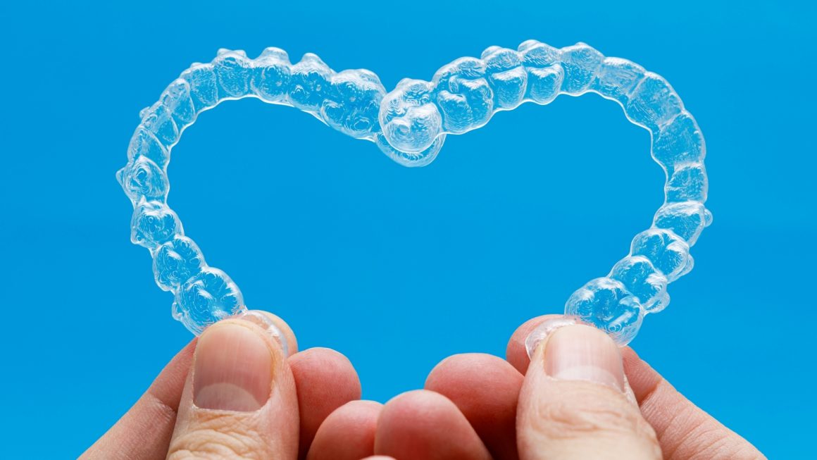 Clear braces/wires (Orthondotic Treatment)