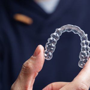 Clear braces/wires (Orthondotic Treatment)