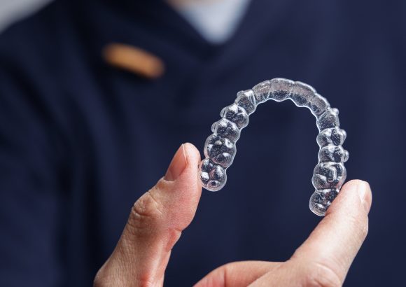 Clear braces/wires (Orthondotic Treatment)