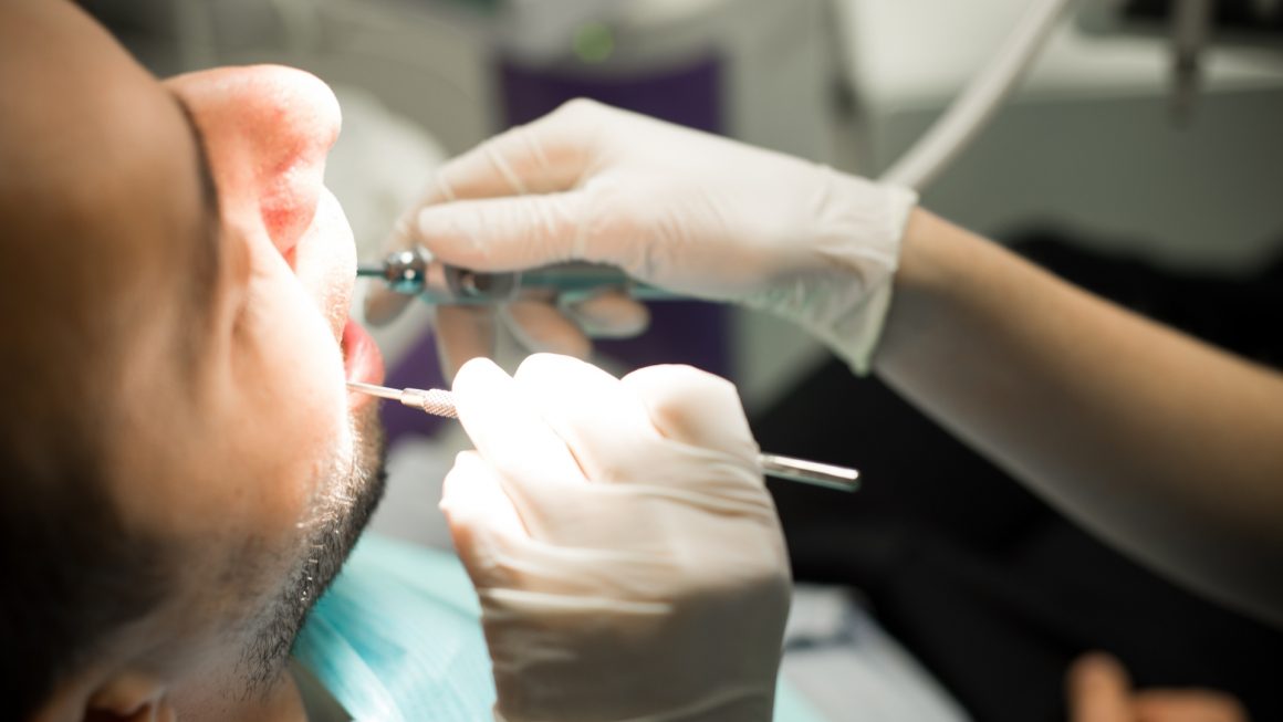 Teeth Cleaning, Scaling and Polishing