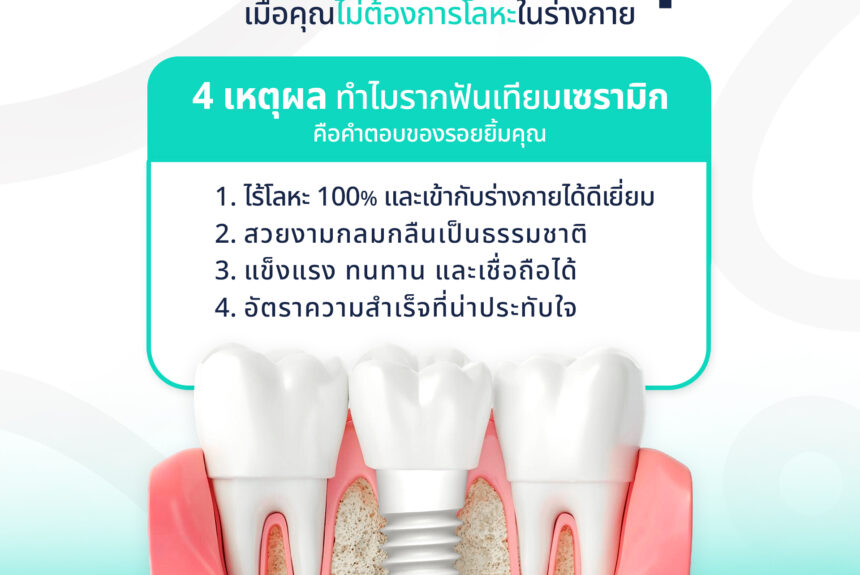 รากฟันเทียมเซรามิก (Ceramic Implants) นวัตกรรมเพื่อรอยยิ้มที่เป็นธรรมชาติ
