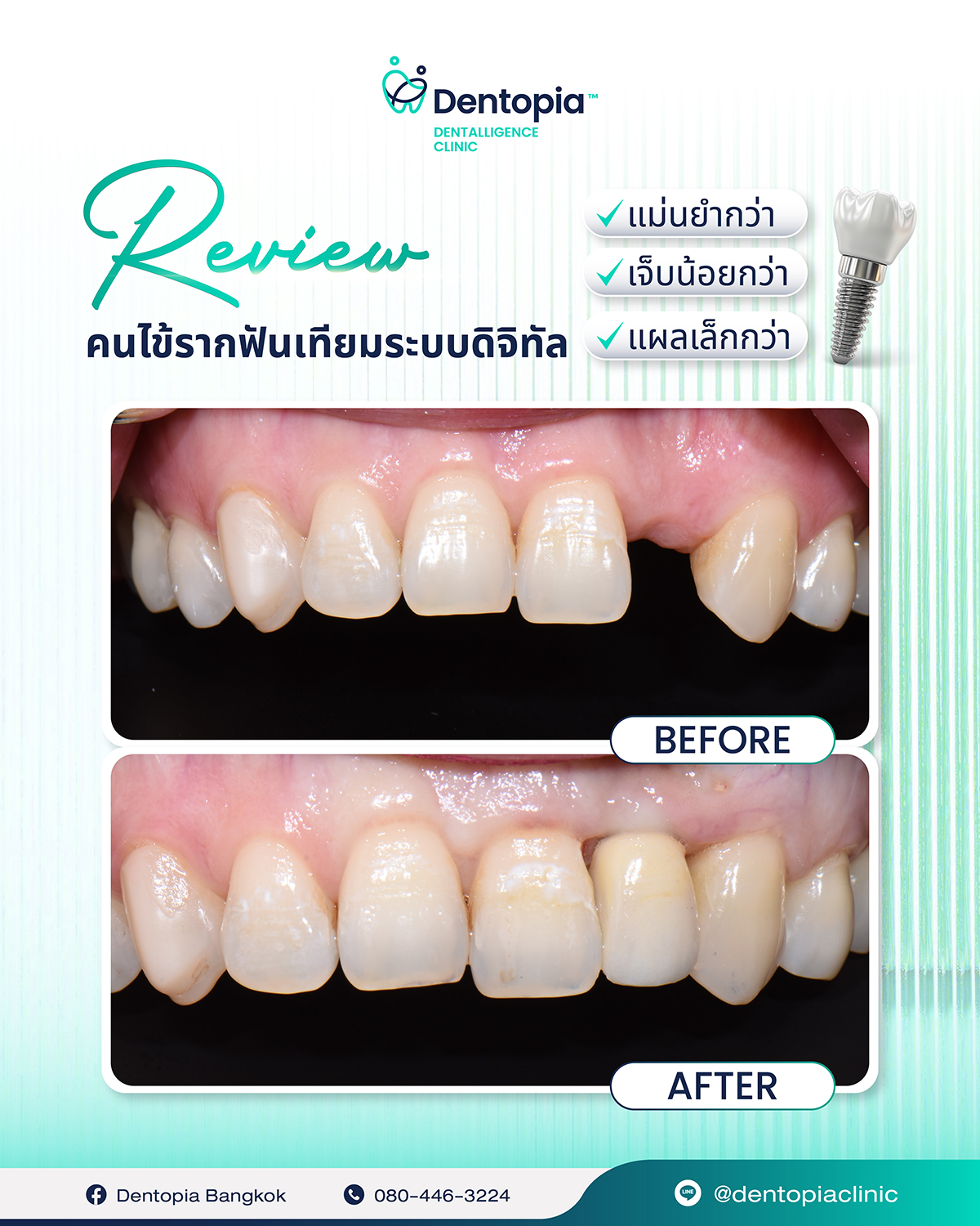 แผนที่ กรอบ ประวัติ รีวิว-10