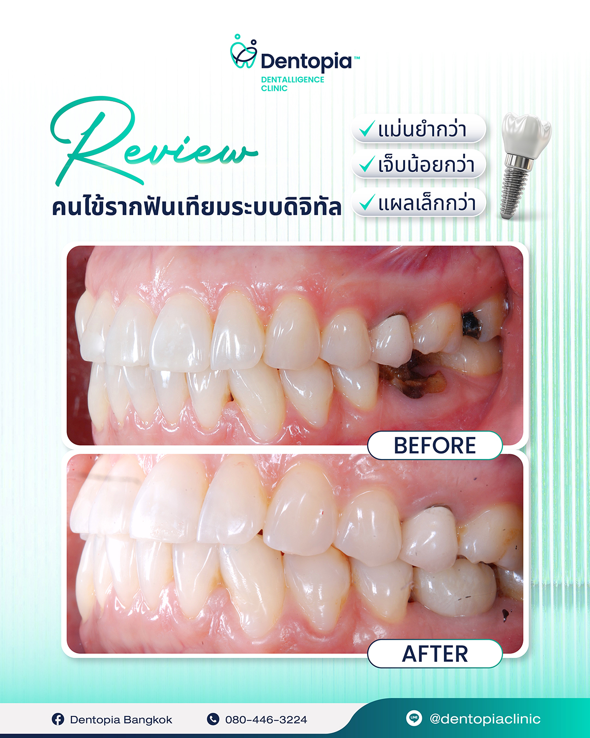 แผนที่ กรอบ ประวัติ รีวิว-11