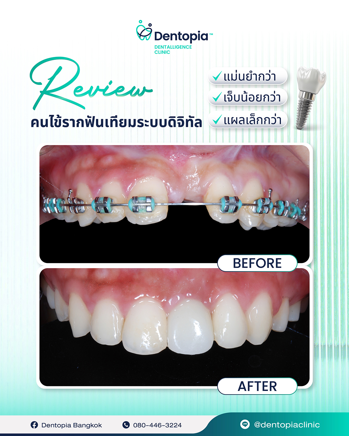 แผนที่ กรอบ ประวัติ รีวิว-12