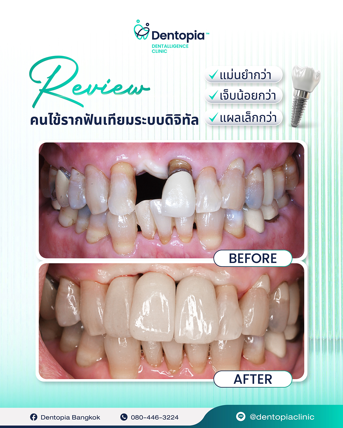 แผนที่ กรอบ ประวัติ รีวิว-13