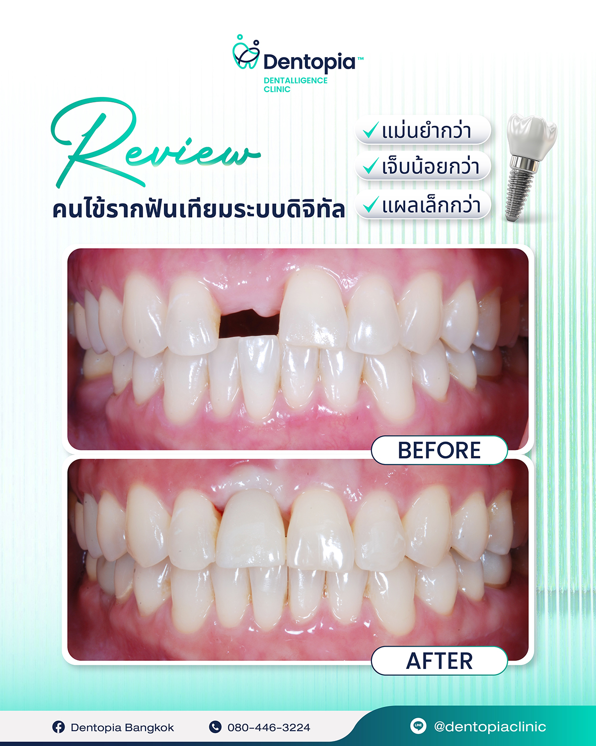 แผนที่ กรอบ ประวัติ รีวิว-14