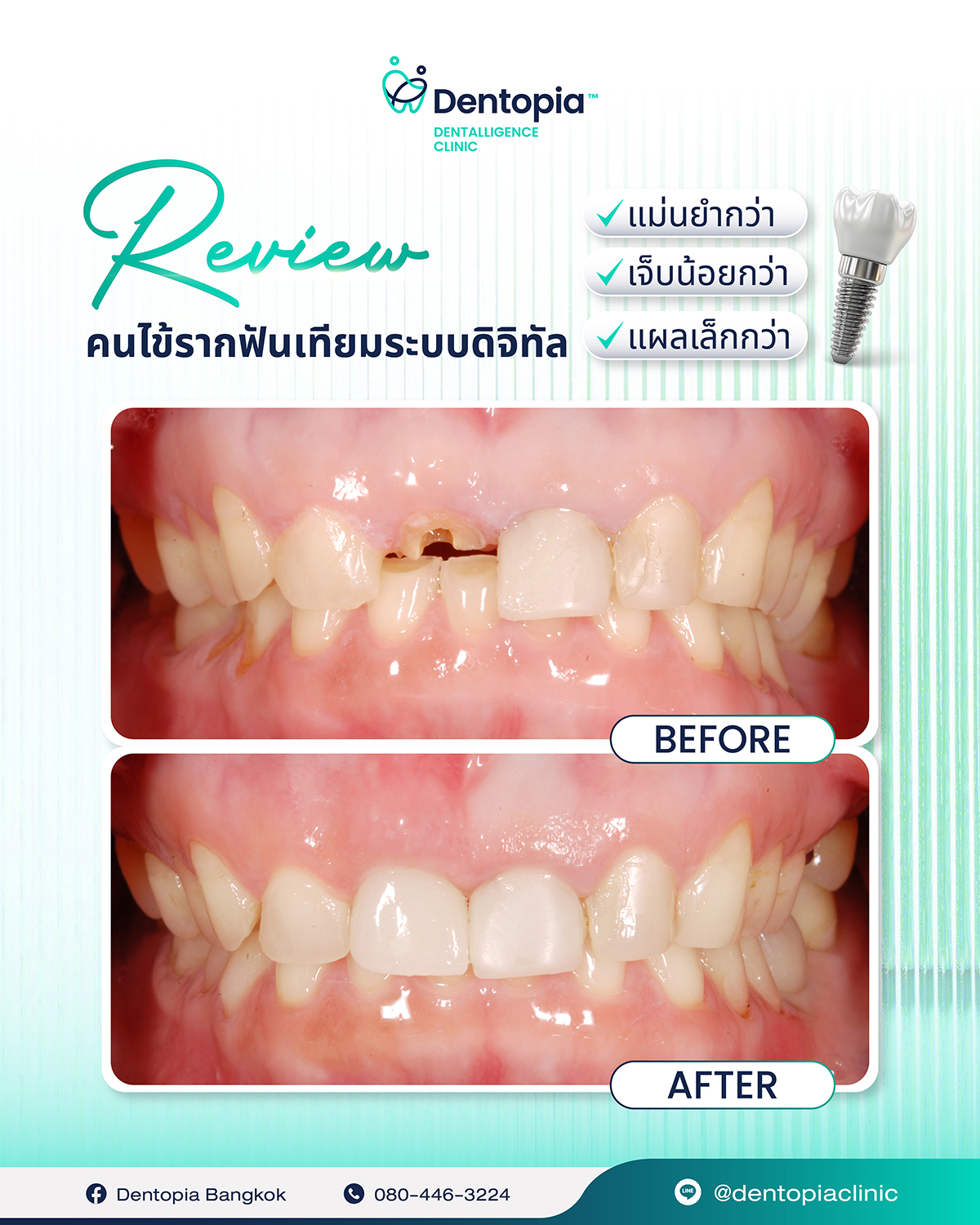 แผนที่ กรอบ ประวัติ รีวิว-15
