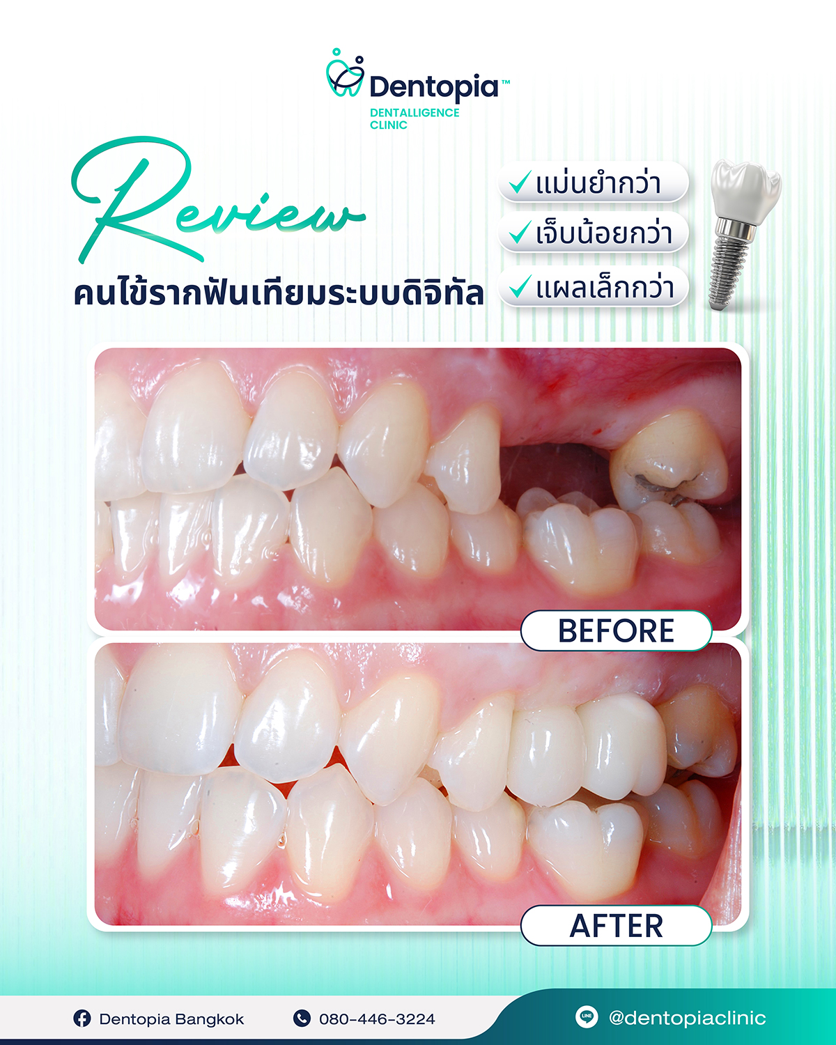 แผนที่ กรอบ ประวัติ รีวิว-16