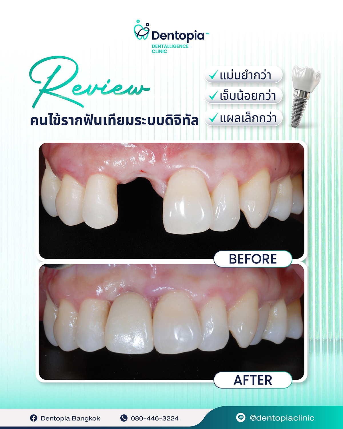 ✅(11_3_26)แผนที่ กรอบ ประวัติ รีวิว-07