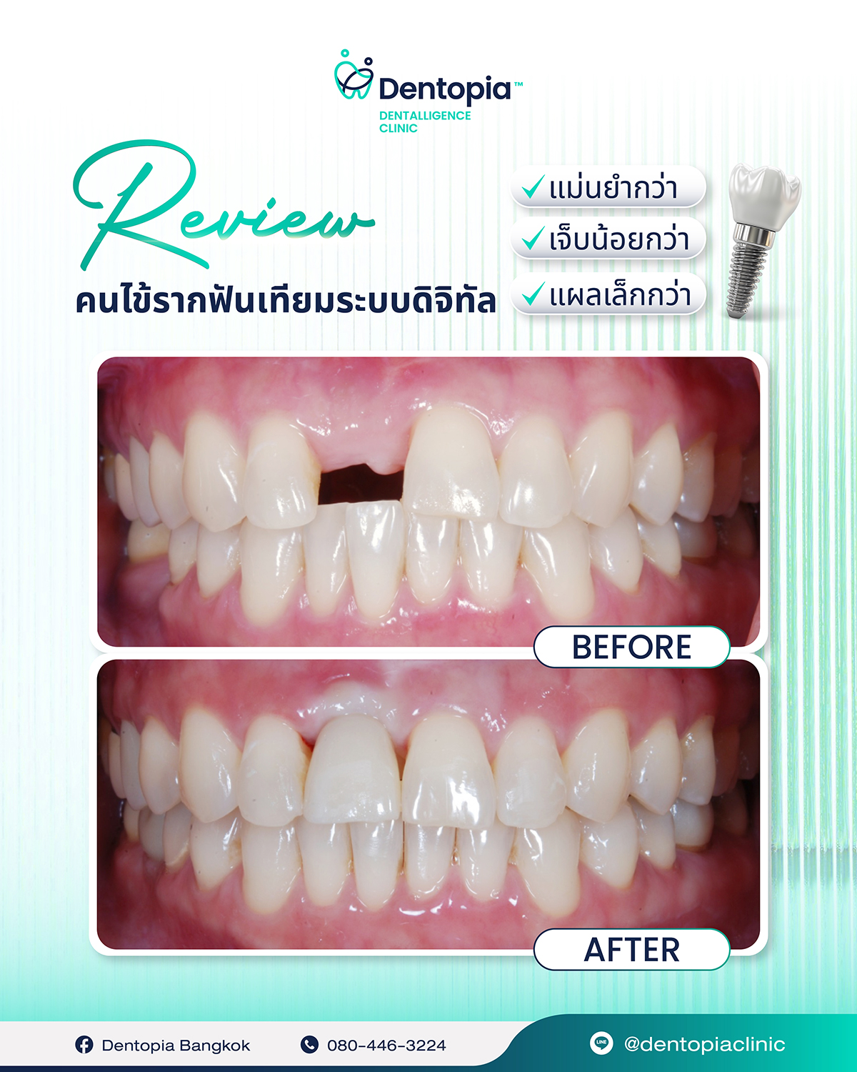 ✅(18_3_26)แผนที่ กรอบ ประวัติ รีวิว-08
