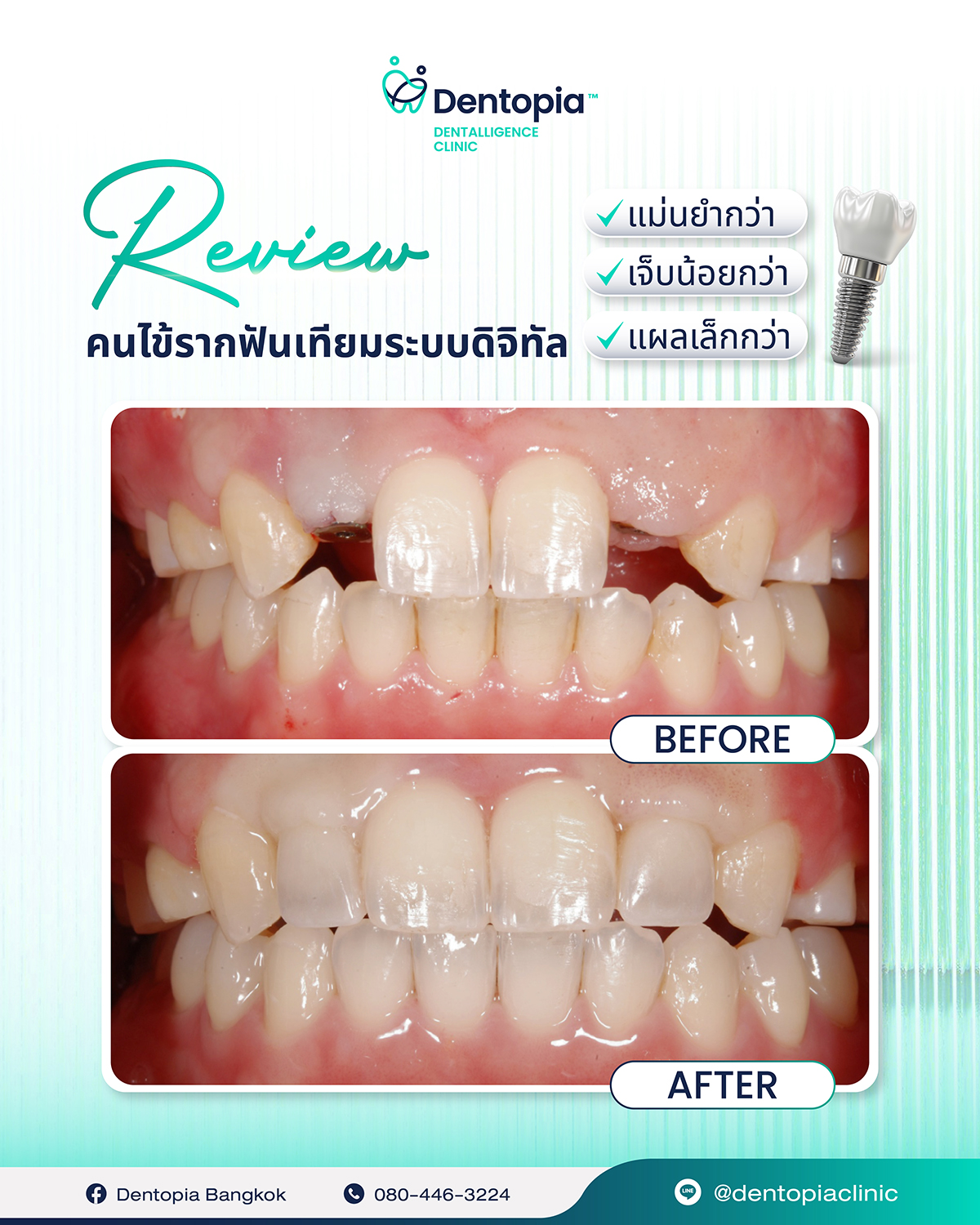 ✅(25_3_26)แผนที่ กรอบ ประวัติ รีวิว-09